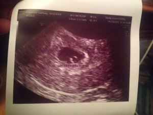 January 28 2015 Ultrasound