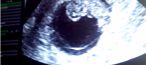 A Sigh of Relief