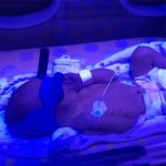 Cool shades in the bilirubin lights